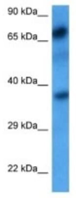 Polypeptide GalNac Transferase 7/GALNT7 Rabbit anti-Human, Polyclonal, Novus Biologicals 100 &mu;g | Buy Online | Novus Biologicals | Fisher Scientific